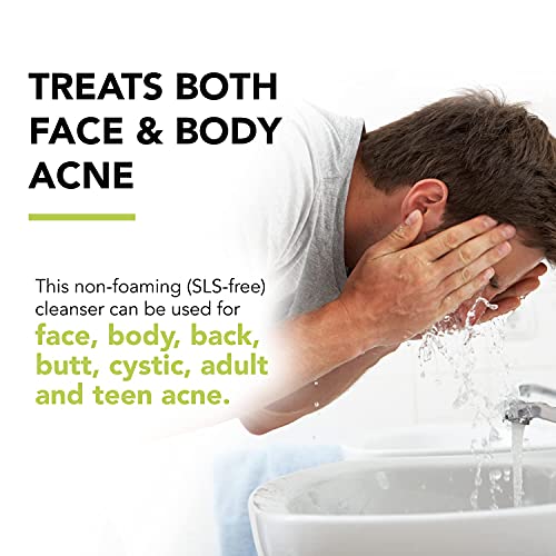 DermaHarmony Maximum-Strength Acne Wash (10% Benzoyl Peroxide) - 8 Fl Oz - Non-Foaming Cleanser for Face, Skin, Butt, Back & Body - Dermatologist-Tested, Vegan & Cruelty-Free.