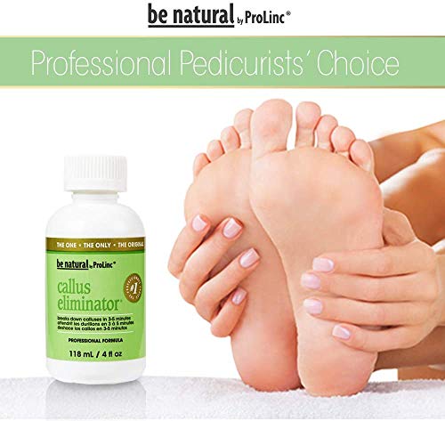 ProLinc Fast-Acting Callus Remover (4 oz).