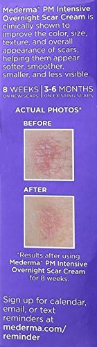 Mederma PM Intensive Overnight Scar Cream, 1oz (Pack of 1)