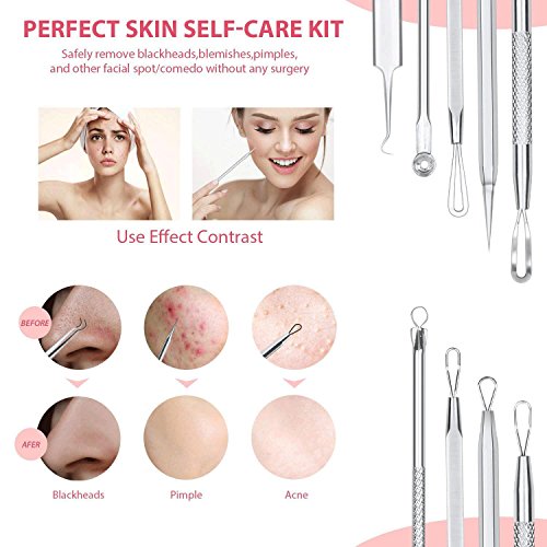 JPNK 6-Piece Comedones Extractor Acne Removal Kit (Blackhead Remover) for Popping Blemish, Whitehead, and Zit Removing on Nose and Face, Includes Leather Bag (Silver)
