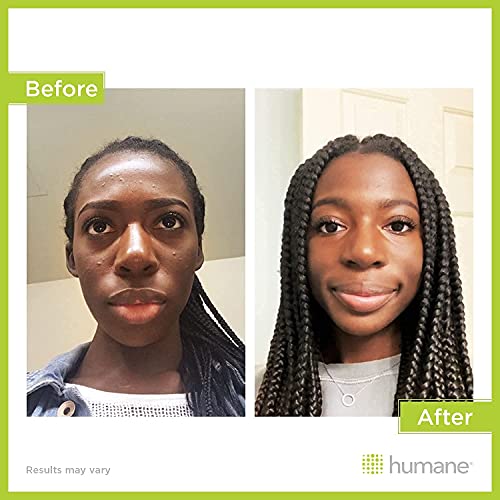 DermaHarmony Maximum-Strength Acne Wash (10% Benzoyl Peroxide) - 8 Fl Oz - Non-Foaming Cleanser for Face, Skin, Butt, Back & Body - Dermatologist-Tested, Vegan & Cruelty-Free.