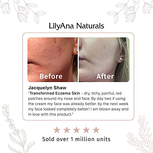 LilyAna Naturals Face Moisturizer (1.7oz), for Women & Men. Anti-Aging, Dry Skin & Dark Spot Brightening, with Rose & Pomegranate Extracts. Made in USA.