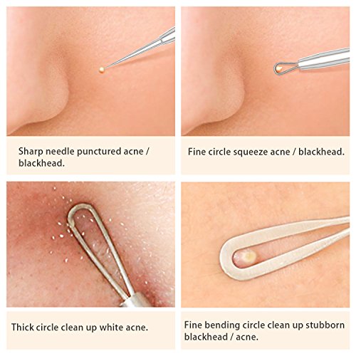 Blackhead Remover Kit (By Pimple Popper) - Extractor Tool for Acne, Whiteheads & Blemishes - Stainless Steel